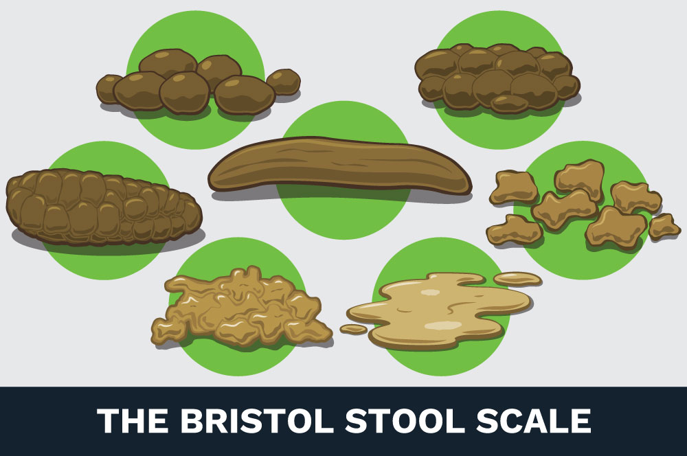 Nature's Calling the Bristol stool scale